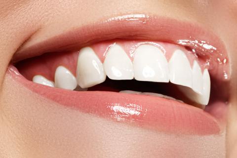 стоматология, стоматолог, отбеливание, тёмные зубы, отбелить зубы, лечение зубов
