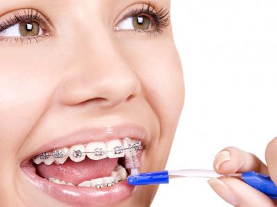 стоматология, детская стоматология, брекеты, ортодонт, кривые зубы, исправление кривых зубов, лечение, поставить брекеты